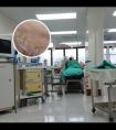 鲁索替尼乳膏使用最新消息